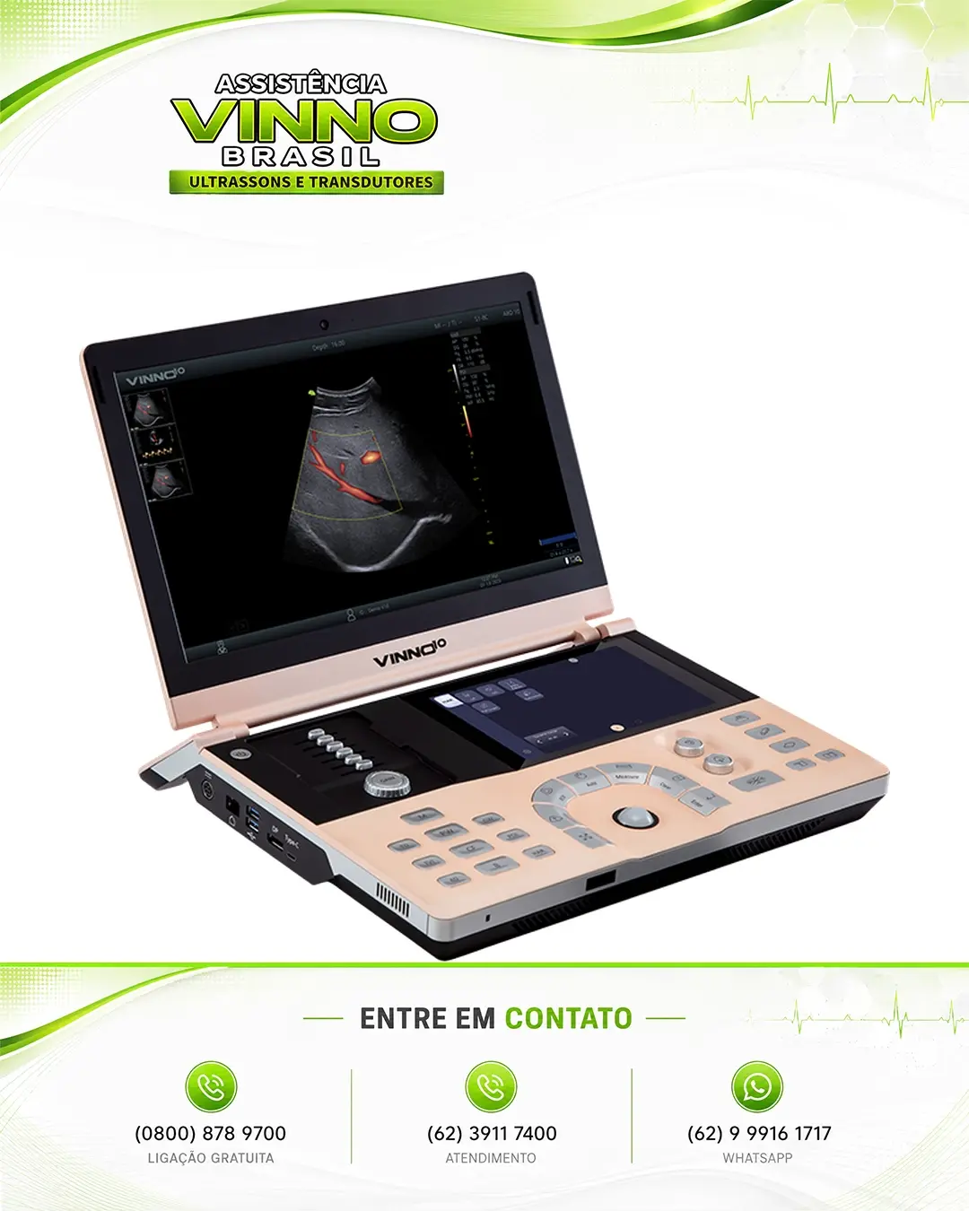 ASSISTÊNCIA TÉCNICA ULTRASSOM VINNO 10 NO BRASIL