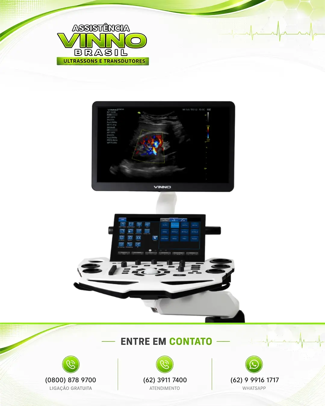MANUTENÇÃO DE ULTRASSOM VINNO S300 GOIÂNIA