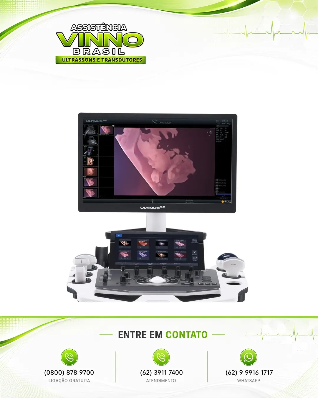 SUPORTE TÉCNICO PARA ULTRASSOM VINNO ULTIMUS 9 CUIABÁ